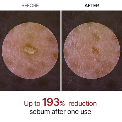 Dr.Melaxin Peel Shot - Glow Rice Peeling Ampoule, Soft Exfoliating Dead Skin Cells Remover